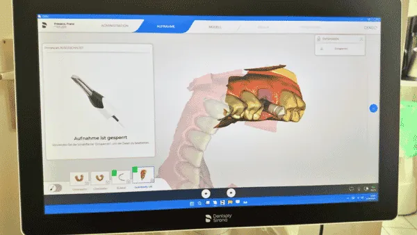 3d dental scan workflow with cad cam software cerec modern cerec teaching